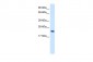 HMGB3 antibody - C-terminal region